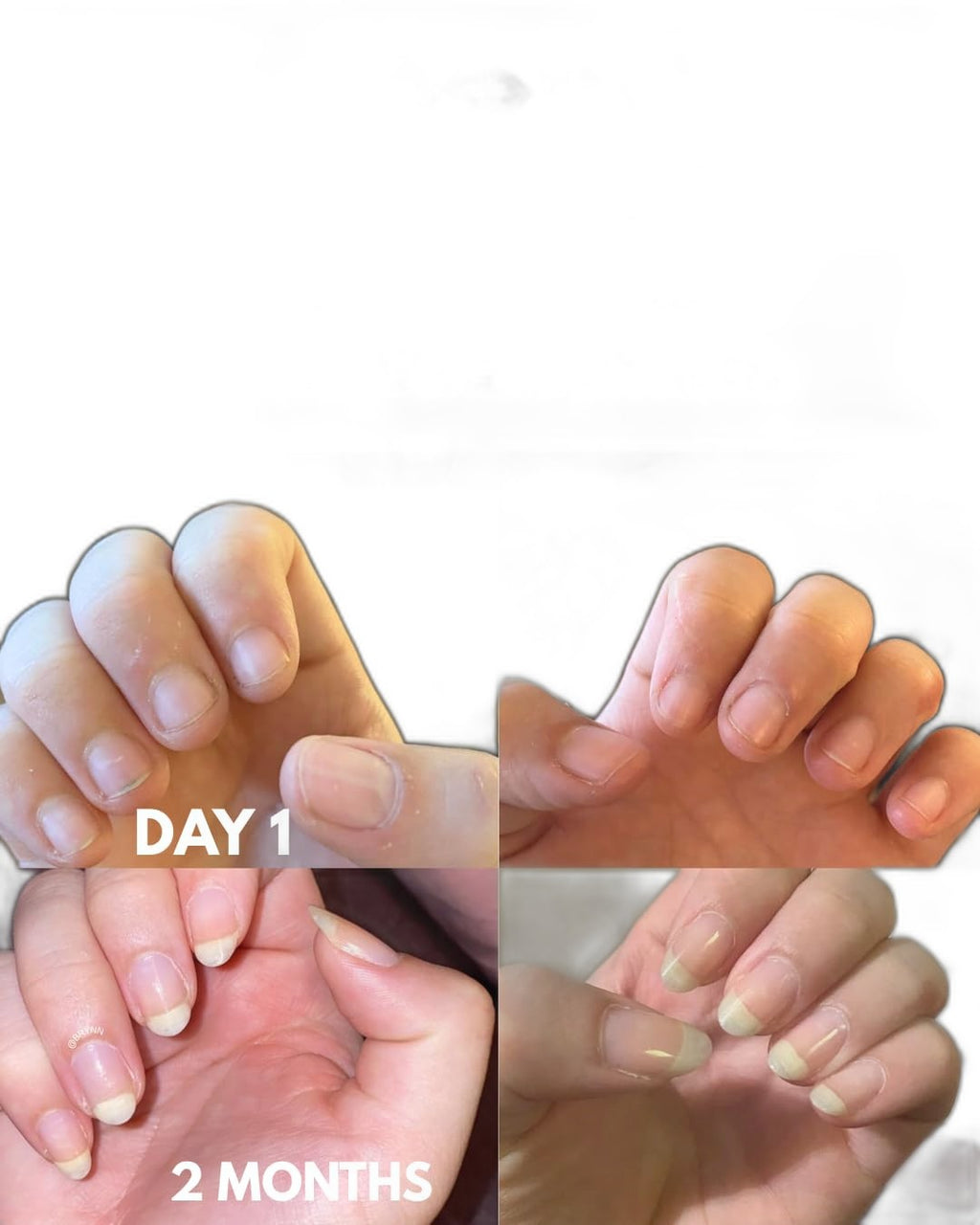 Bliss Kiss Nail Oil Pen | Nourish & Strengthen Brittle Nails - view 2